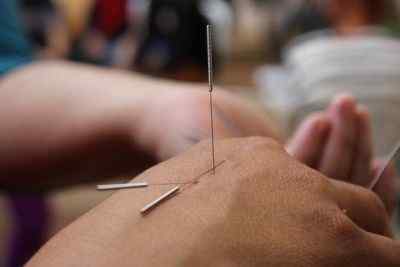 Différence entre l'acupuncture et l'acupression