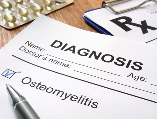 Unterschied zwischen akuter und chronischer Osteomyelitis