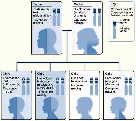 Perbedaan antara alpha thalassemia dan beta thalassemia