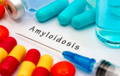 Różnica między amyloidozą a szpiczakiem mnogim