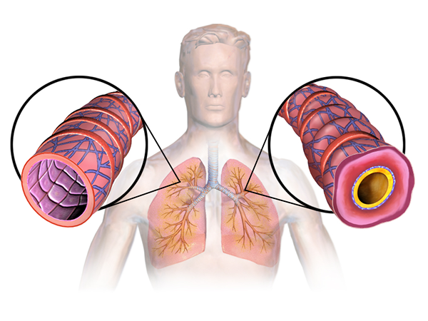 Différence entre l'asthme et les problèmes cardiaques