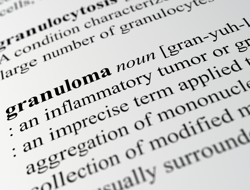 Perbezaan antara granuloma caseating dan noncaseating