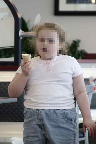 Perbezaan antara obesiti dan kemurungan kanak -kanak