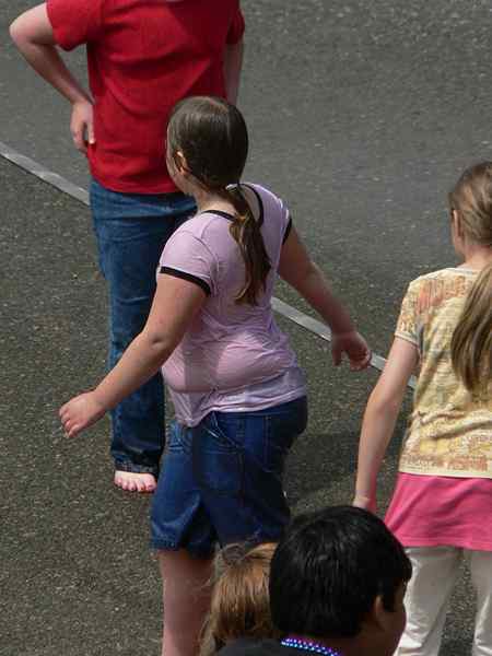 Perbedaan antara obesitas anak dan kelebihan berat badan