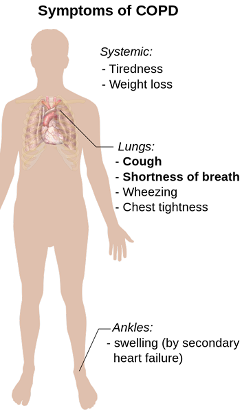 Perbezaan antara COPD dan CHF