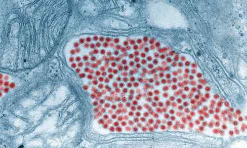 Différence entre le cytoplasme et le protoplasme