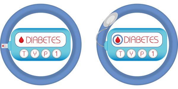 Unterschied zwischen Diabetes und Insulinresistenz