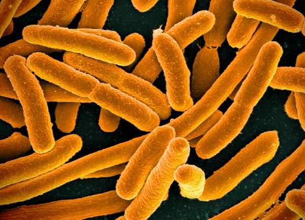 Różnica między e. Coli i Klebsiella