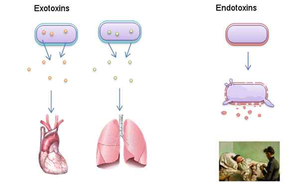 Unterschied zwischen Endotoxinen und Exotoxinen