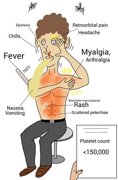 Diferencia entre la epistaxis y la hemoptisis