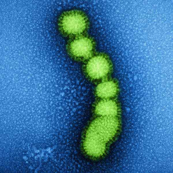 Différence entre la grippe et la septicémie