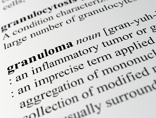 Perbezaan antara granuloma dan keloid