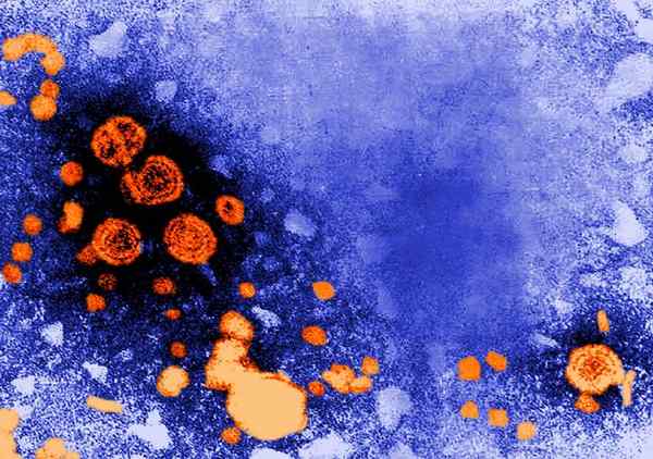 Perbedaan antara hepatitis dan sirosis