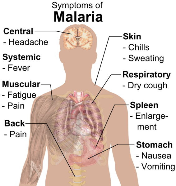 Diferencia entre la malaria y el dengue