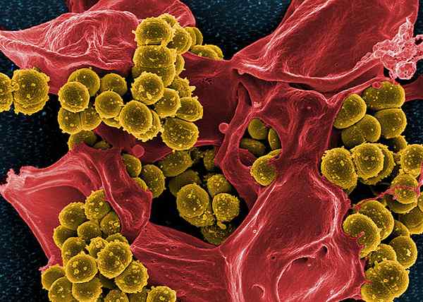 Perbedaan antara Staphylococcus aureus yang resistan terhadap metisilin (MRSA) dan Staphylococcus aureus