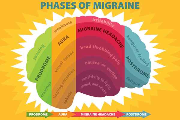 Différence entre la migraine et les maux de tête cervicogéniques