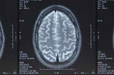 Perbedaan antara MRI dan X-ray