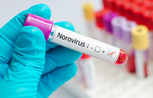 Perbezaan antara norovirus dan Norwalk