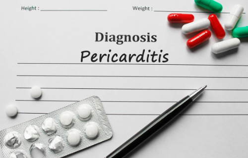 Unterschied zwischen Perikarditis und Myokardinfarkt