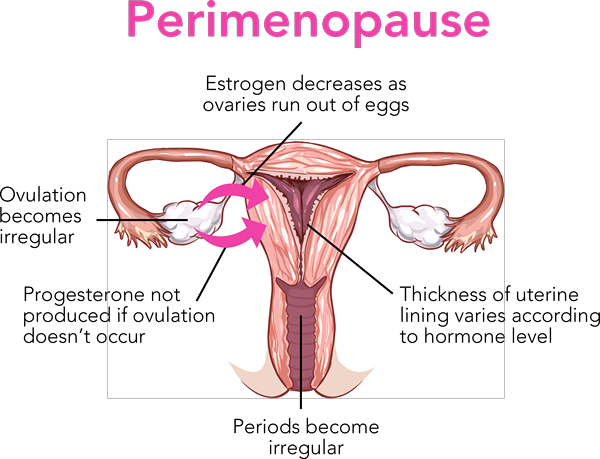 Différence entre la périménopause et la ménopause