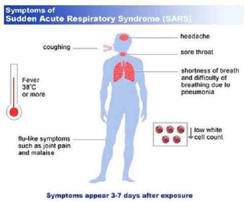 Różnica między SARS i H1N1