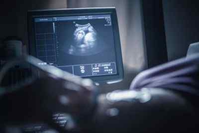 Perbedaan antara sonogram dan ultrasound