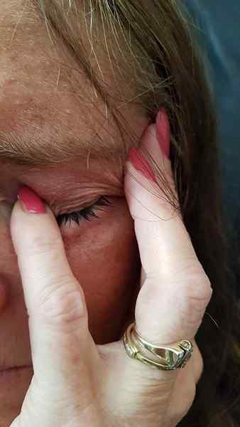 Diferencia entre el dolor de cabeza de tensión y el dolor de cabeza del clúster