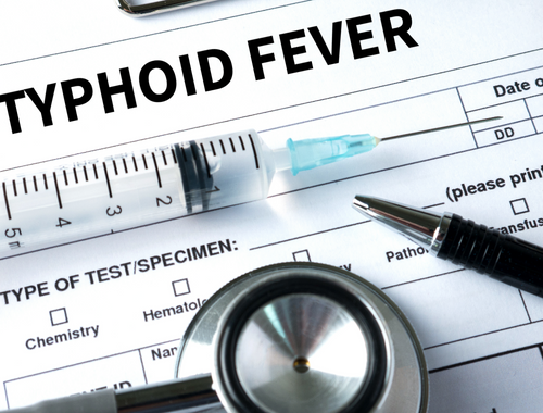 Différence entre la typhoïde et le typhus