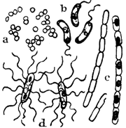 Diferencia entre las bacterias aeróbicas y anaeróbicas