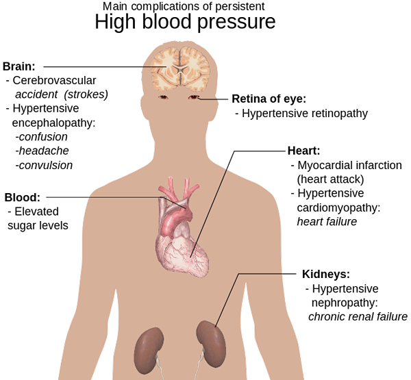 Différence entre l'amlodipine et l'amlodipine Besylate