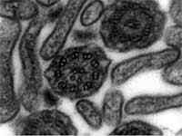 Perbezaan antara silia dan microvillus