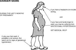 Différence entre l'hypertension gestationnelle et la prééclampsie