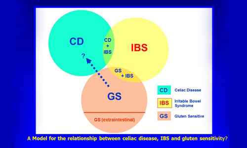 Perbedaan antara IBS dan penyakit celiac