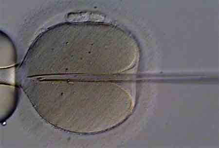 Różnica między IVF i ICSI