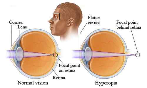 Diferencia entre la visión cercana y la visión lejana