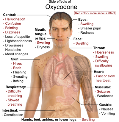 Diferencia entre oxicontina y oxicodona