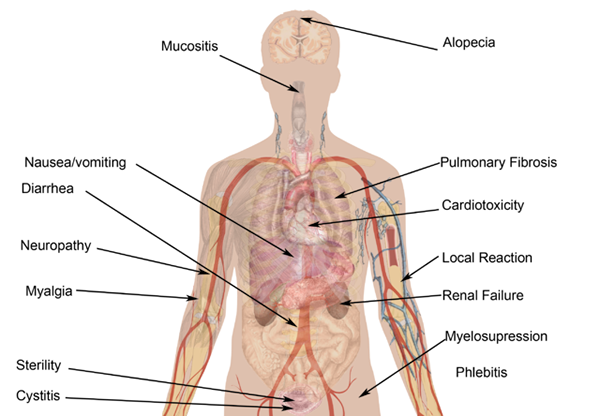 Différence entre la radiation et la chimiothérapie