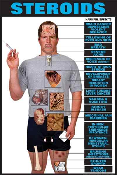 Unterschied zwischen Steroid und Testosteron