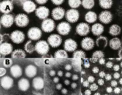 Diferencia entre el malestar estomacal y la gripe estomacal