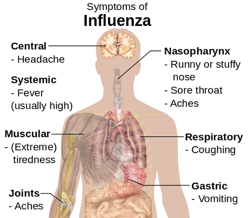 Perbedaan antara flu dan kutu perut