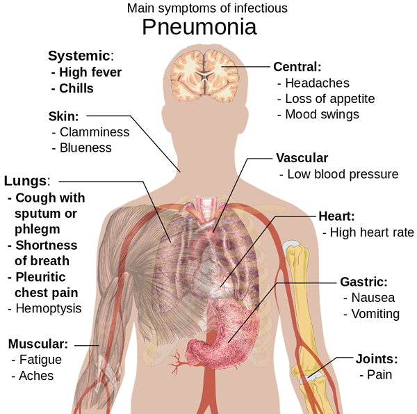 La différence entre la pneumonie et l'hypothermie